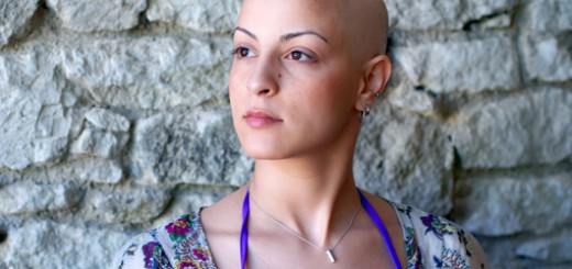 donna senza capelli